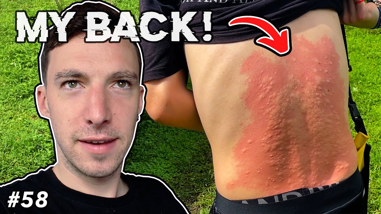 How To Fix Your Sore Back; Amazon Style! - Cuyabeno, Ecuador 🇪🇨 |Ep. 58|