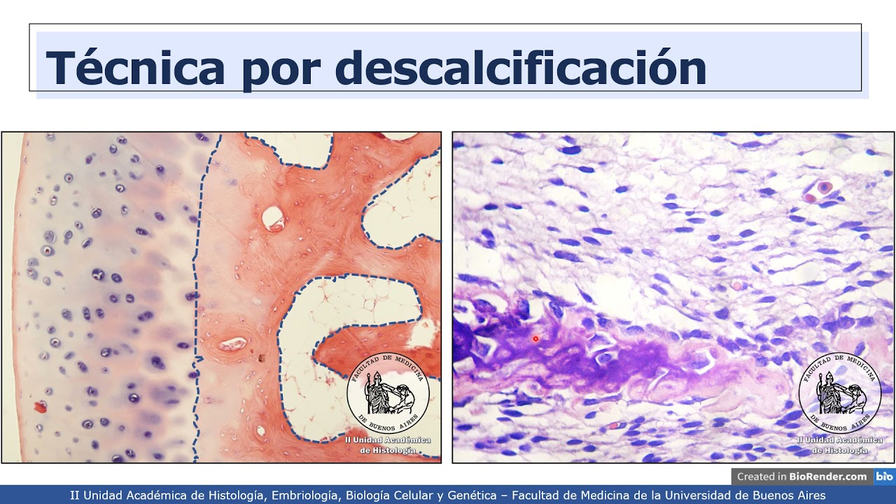 VIDEHISTO #10 | Tejido óseo - Generalidades