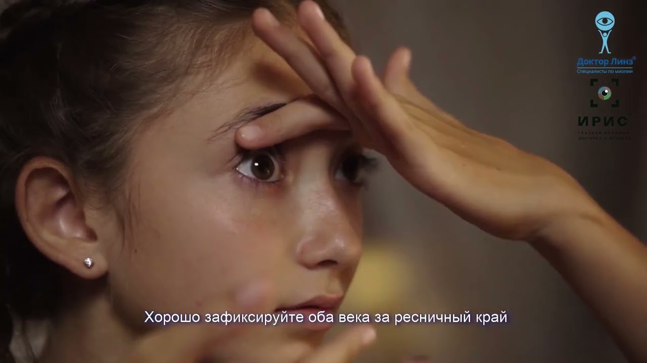 Как одевать ортокератологические линзы