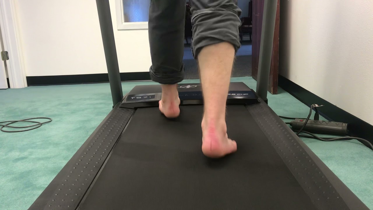 Gait Analysis/ Plantar Fasciitis