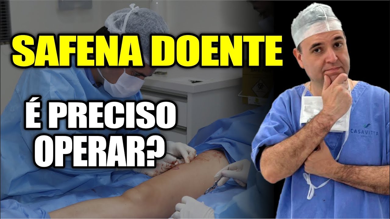 Revelado: VEIA SAFENA doente, &eacute; PRECISO OPERAR? Dr. Alex Responde Ep 12