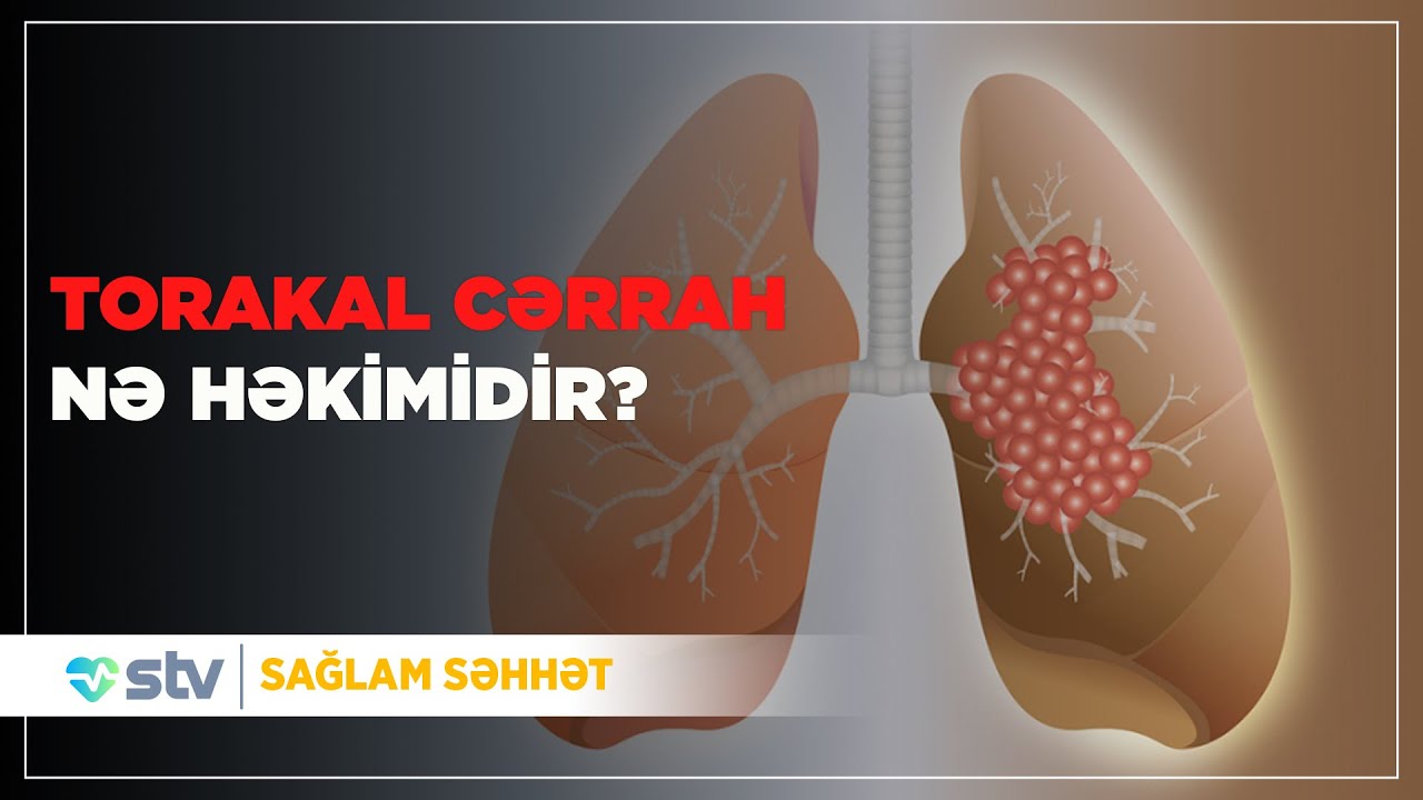 UZM. DR. Fəhmin Əmirov ilə torakal cərrahiyyə haqqında məlumat - (26.05.2025)