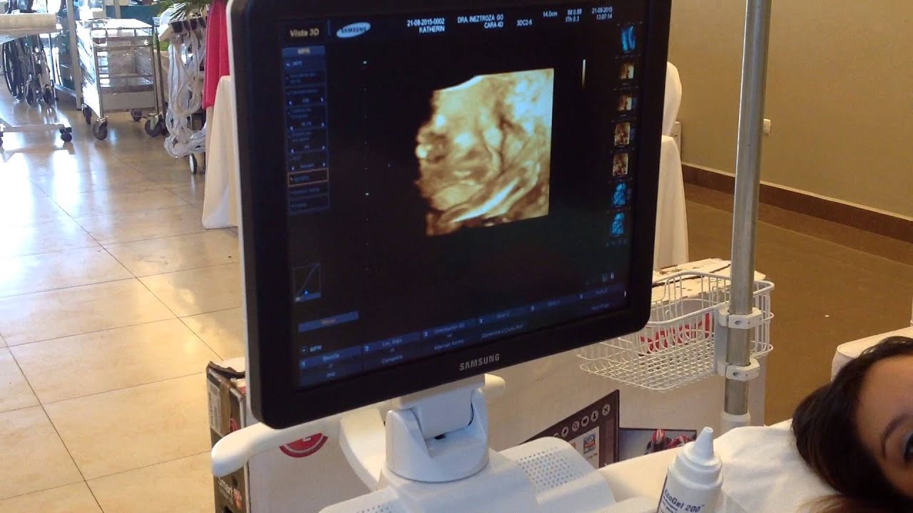 Tecnica y ajuste 3D 4D para R7
