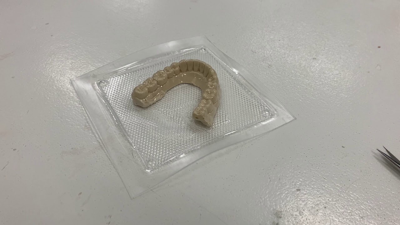 Making Whitening Trays