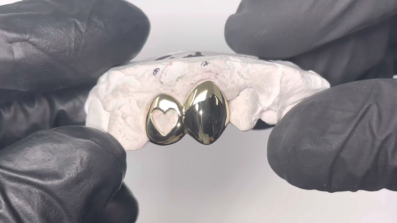 Two Teeth “Double Cap” Grillz w Heart Cut-Out in 14K Yellow Gold | Luxe Grillz