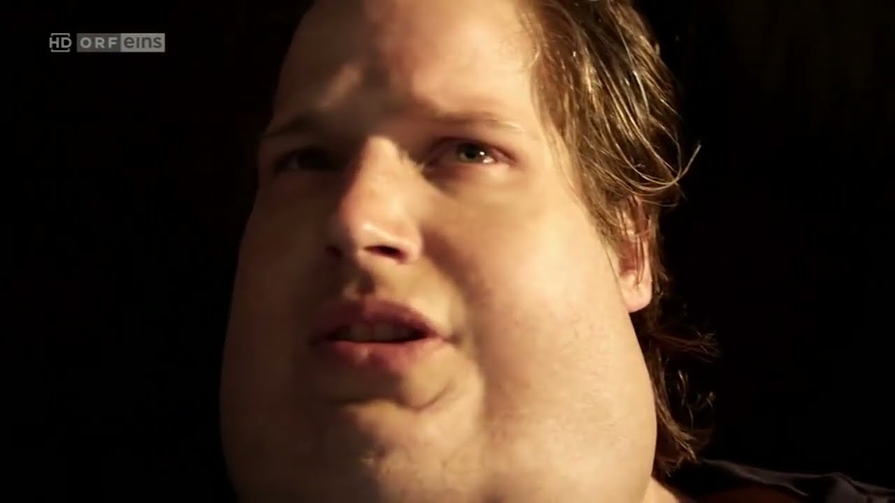 Plötzlich Fett - Nick wakes up HUGE and crush his friend