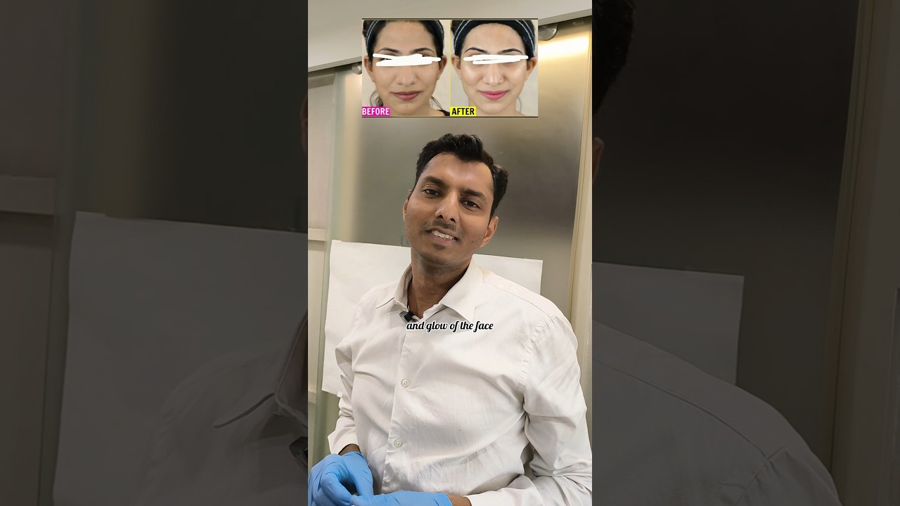 Glutathione skin whitening treatment , glutathione injection #glutathione #skinwhitening