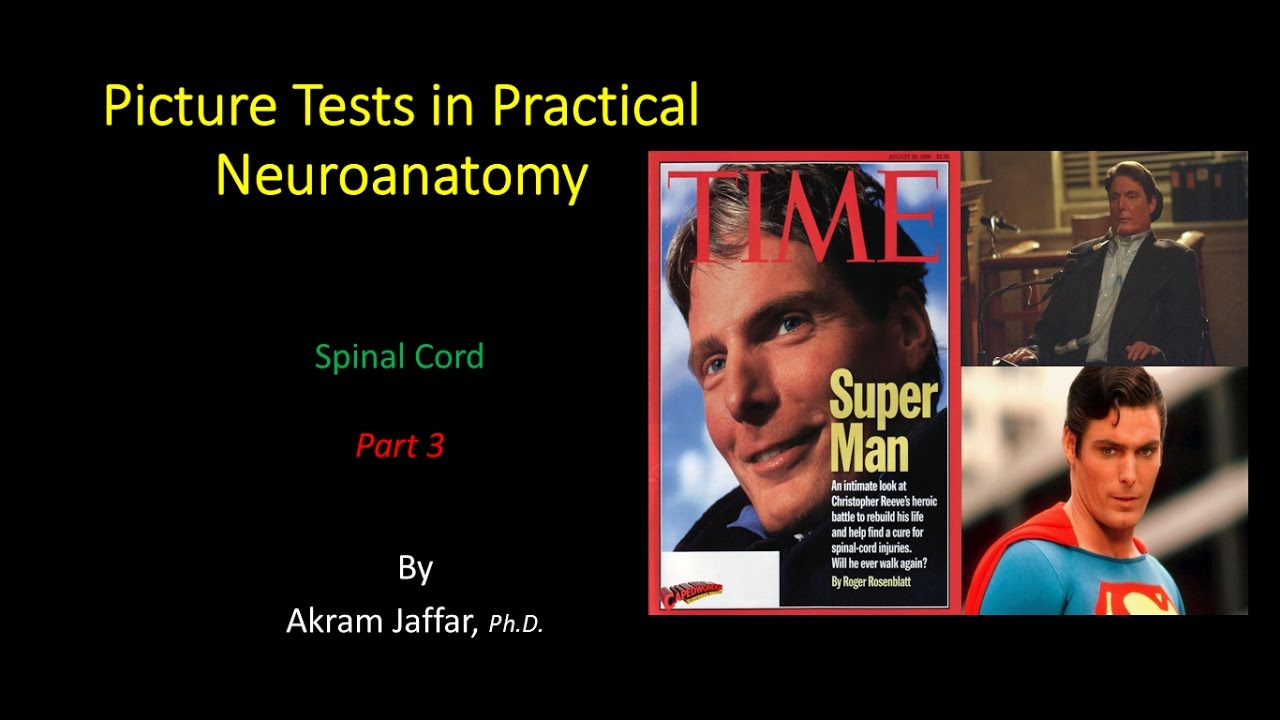 Picture Test in Neuroanatomy - Spinal Cord 3