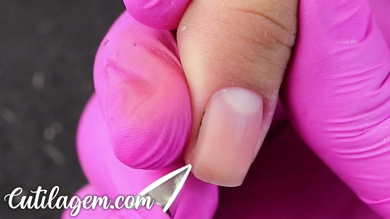 Cutilagem das Unhas da Mão