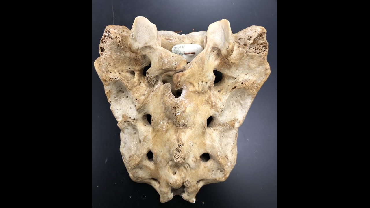 Anatomy of the Sacrum: Part Plus a Brief Overview of Spine-Related Nerves and Their Passageways.