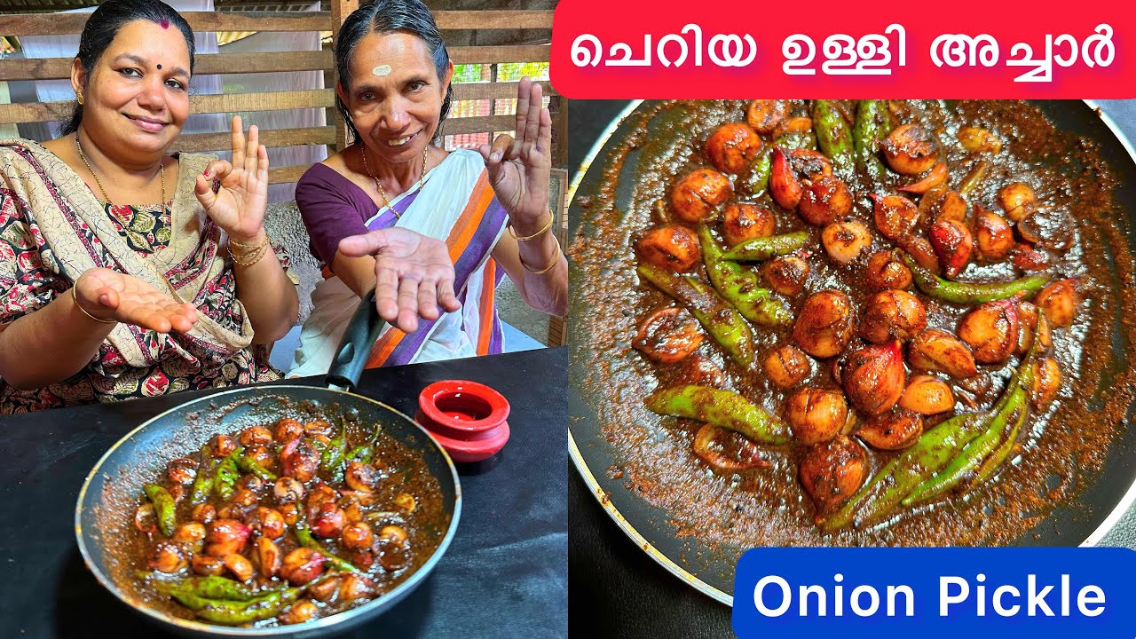 ചെറിയ ഉള്ളി അച്ചാർ വായിൽ കപ്പലോടും😋ഇനി മാങ്ങാ അച്ചാർ മാറി നിൽക്കും | Onion Pickle |