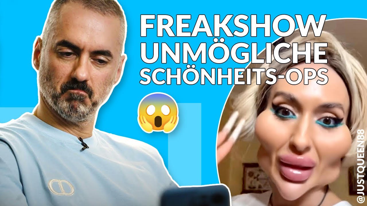 Dein Plastic Surgery Coach &ndash; Freakoperationen: die unm&ouml;glichen Sch&ouml;nheitsoperationen