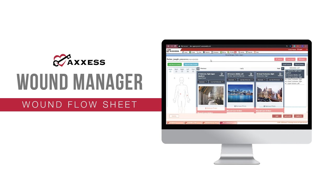 Axxess | Wound Manager: Wound Flowsheet