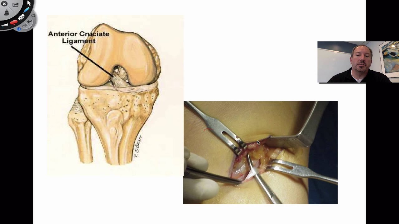 Connective Tissue