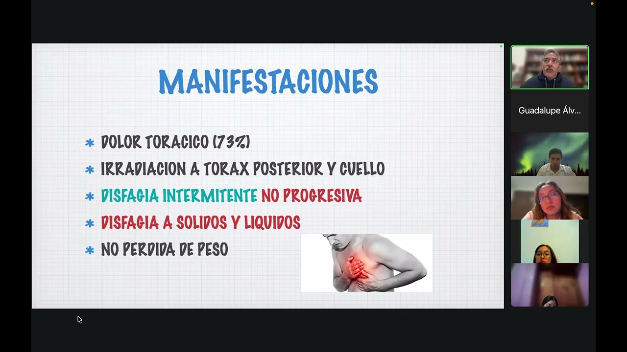 Espasmo esofágico difuso