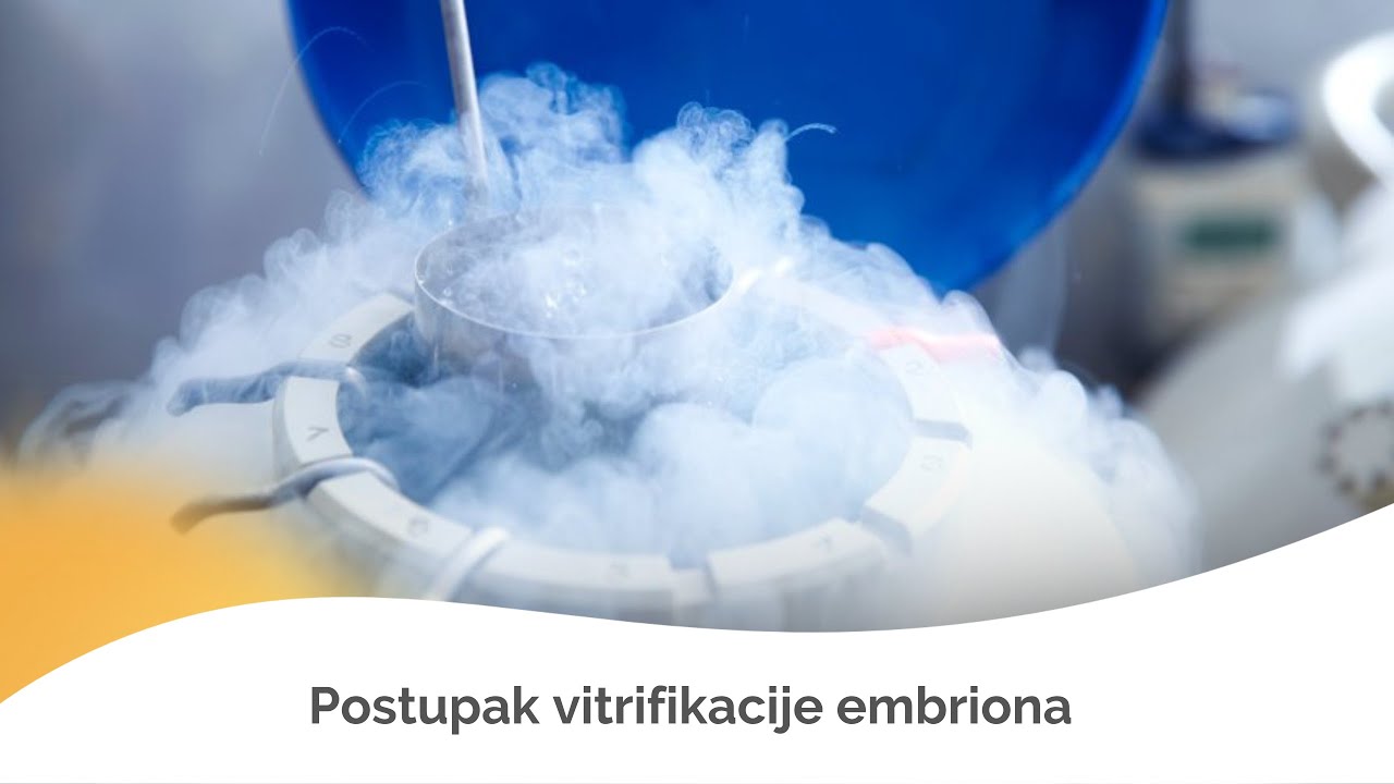 VANTELESNA OPLODNJA| Vitrifikacija - zamrzavanje - embriona | Medico-S