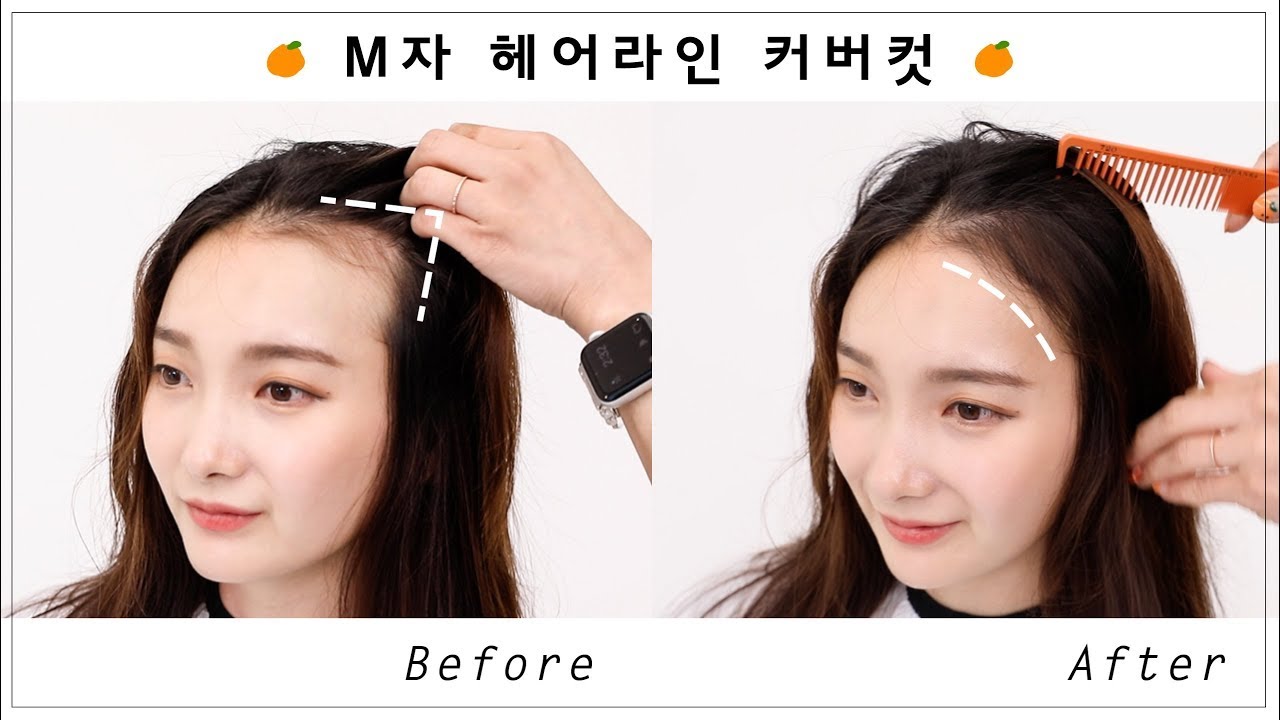 M자 이마, 잔머리로 3분 교정