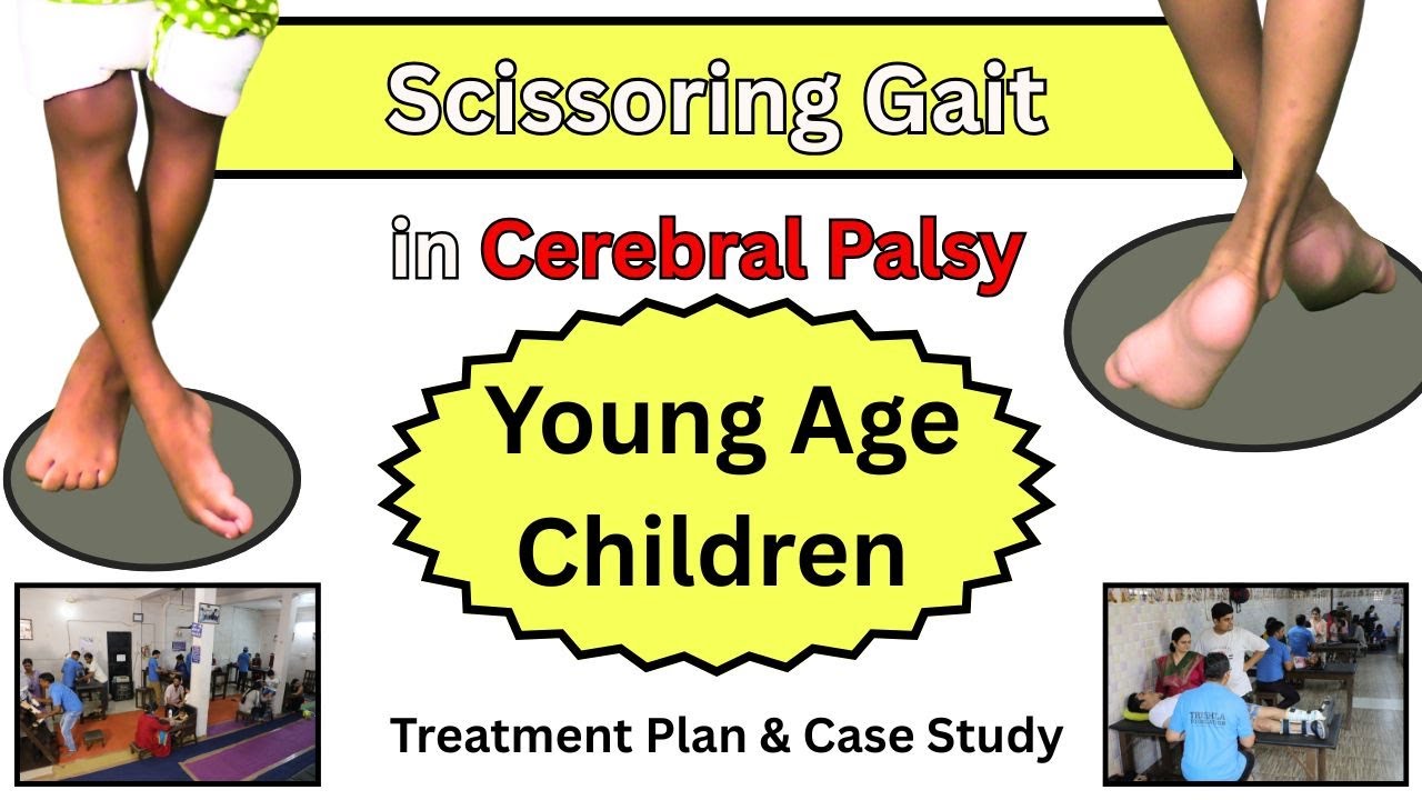 Scissor Gait Cerebral Palsy in Young Children: Treatment Strategy & Case Report—Trishla Foundation