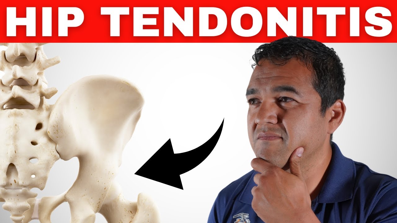 Hip Tendonitis Explained: Understanding its Anatomy, Symptoms, and Root Causes