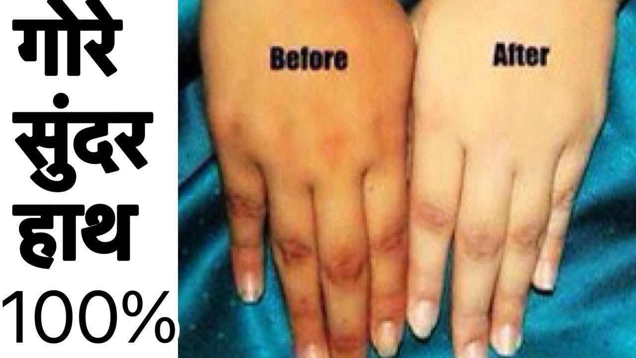 Fair Hands in 5 min | How to get Milky Soft Hands at Home | Skin Whitening Natural Remedy