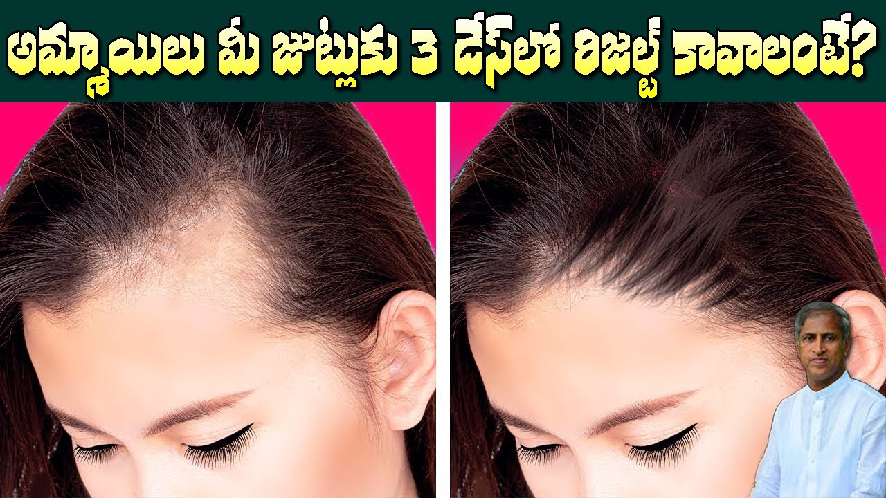 How to Avoid Hair Thinning Naturally | Hair Thickening | Hair Loss | Dr Manthena Satyanarayana Raju