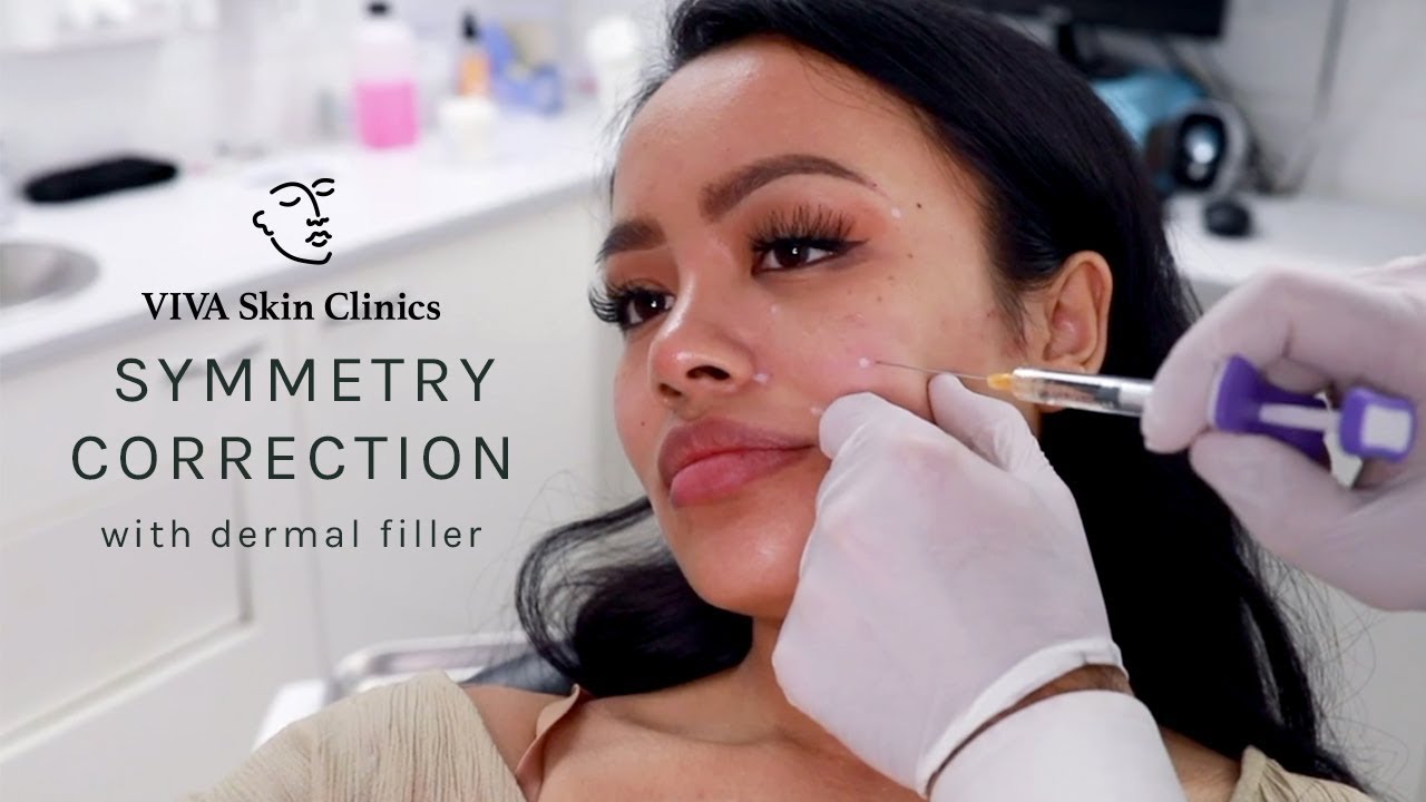 Improving Facial Symmetry with Juvederm Dermal Filler | VIVA Skin Clinics