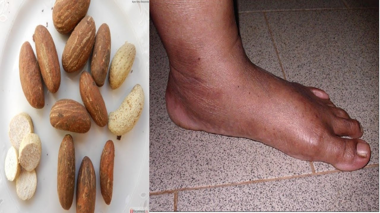 Ton Pieds Gauche Te Donne La  Malchance Dans  La Vie !