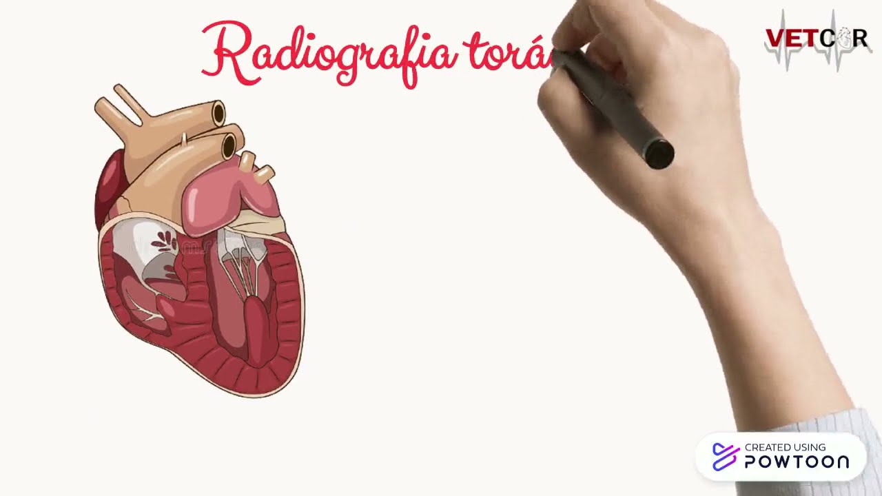 Radiografia torácica