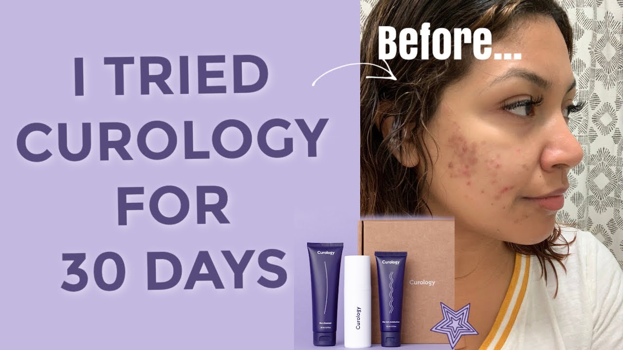 CUROLOGY review  *NOT SPONSORED* | did it work??☹️