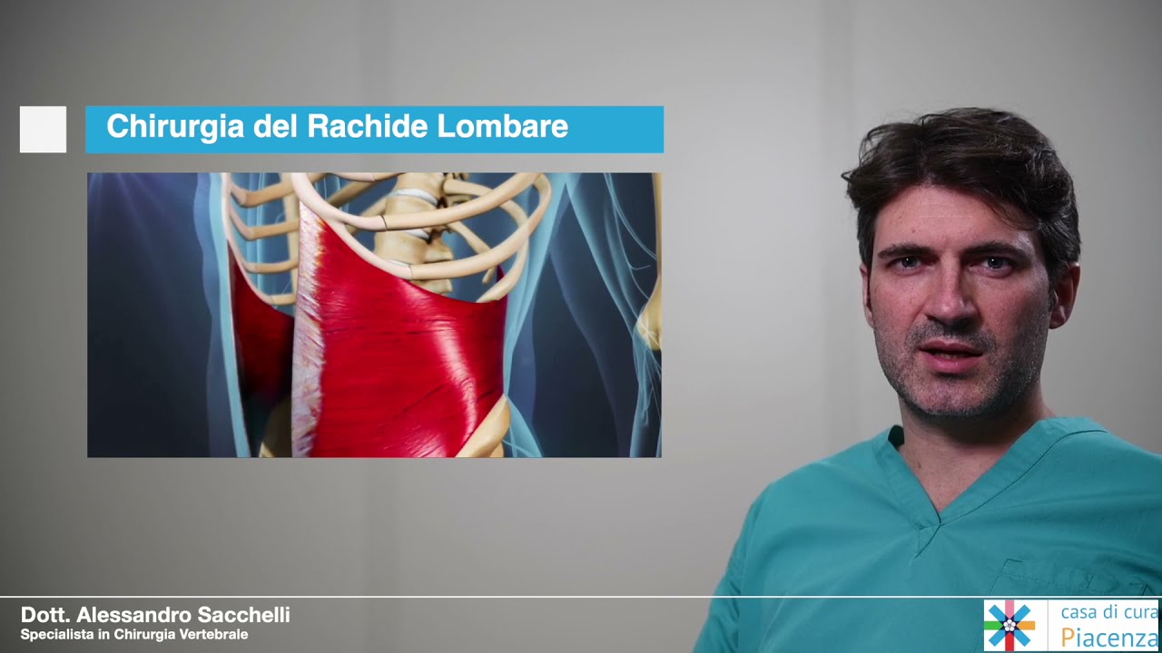 Dott. Alessandro Sacchelli - Chirurgia del Rachide Lombare