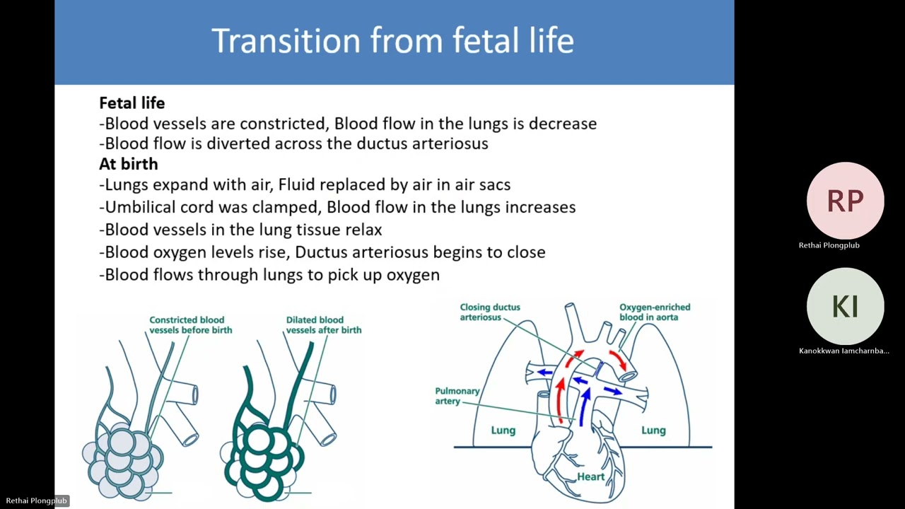 Respiratory distress in the newborn