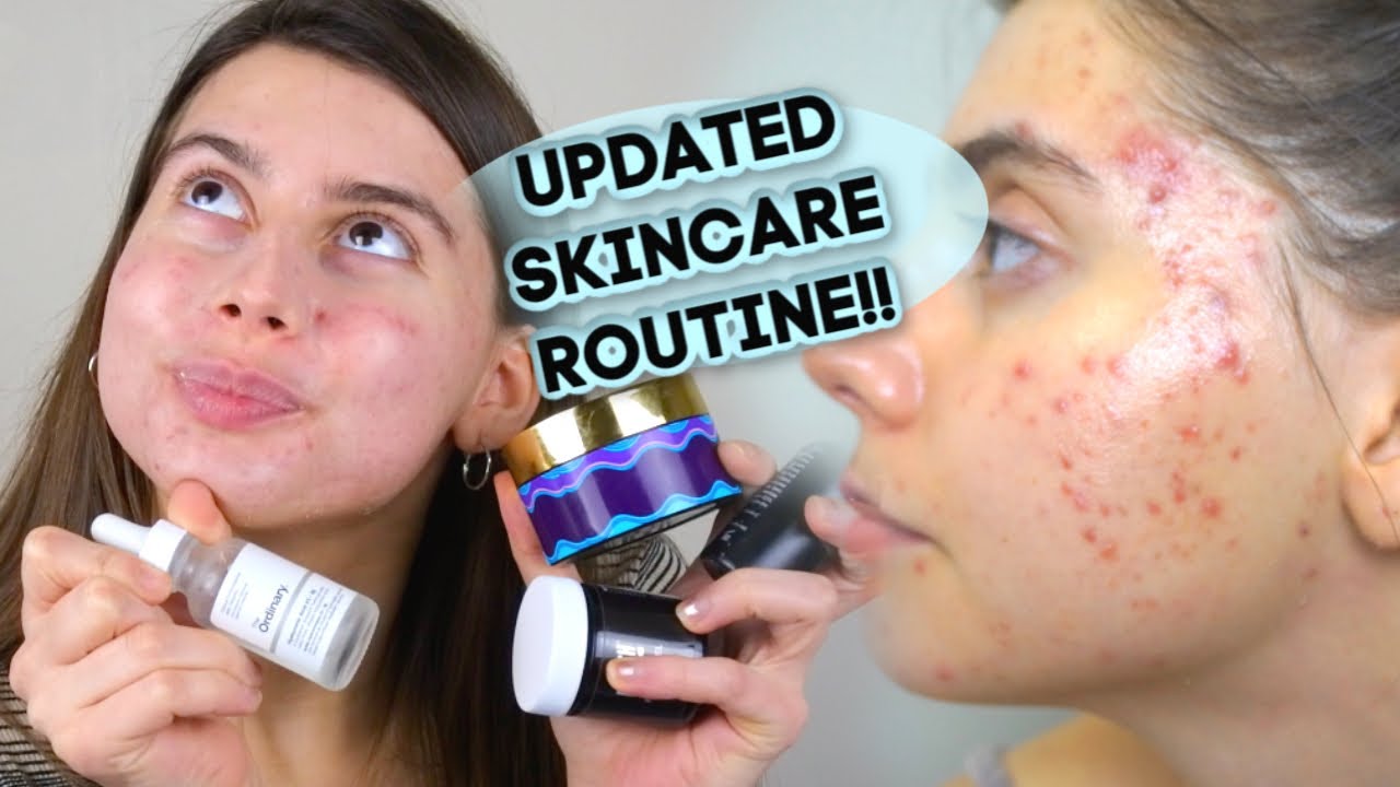 MY UPDATED SKINCARE ROUTINE FOR ACNE!! || scarring, chit chat new music, being stressed LOL!!