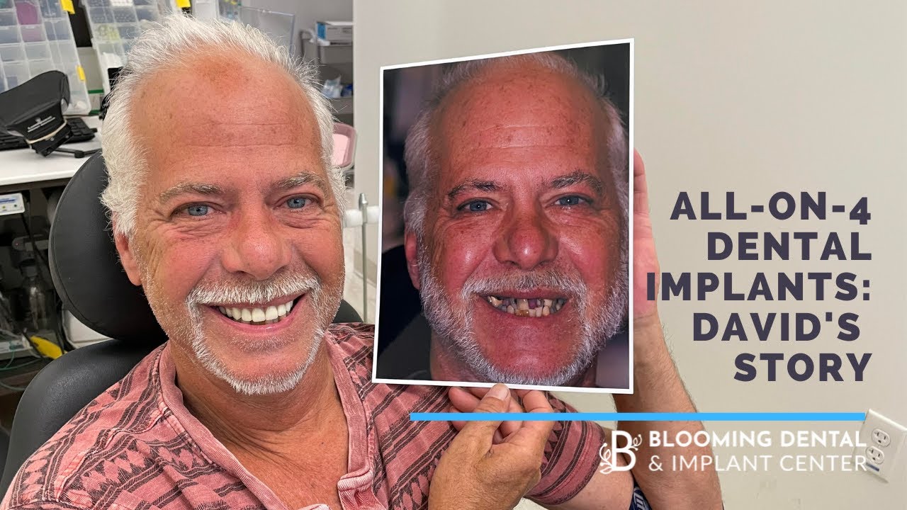 All-On-4 Dental Implants: David's Story