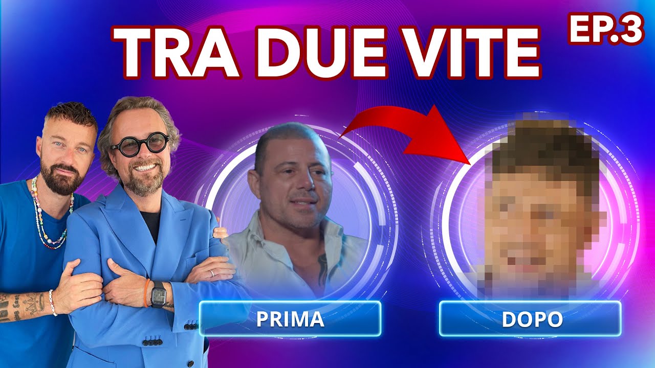 TRA DUE VITE | EP.3 | GIUSEPPE E L'ALOPECIA ANDROGENETICA