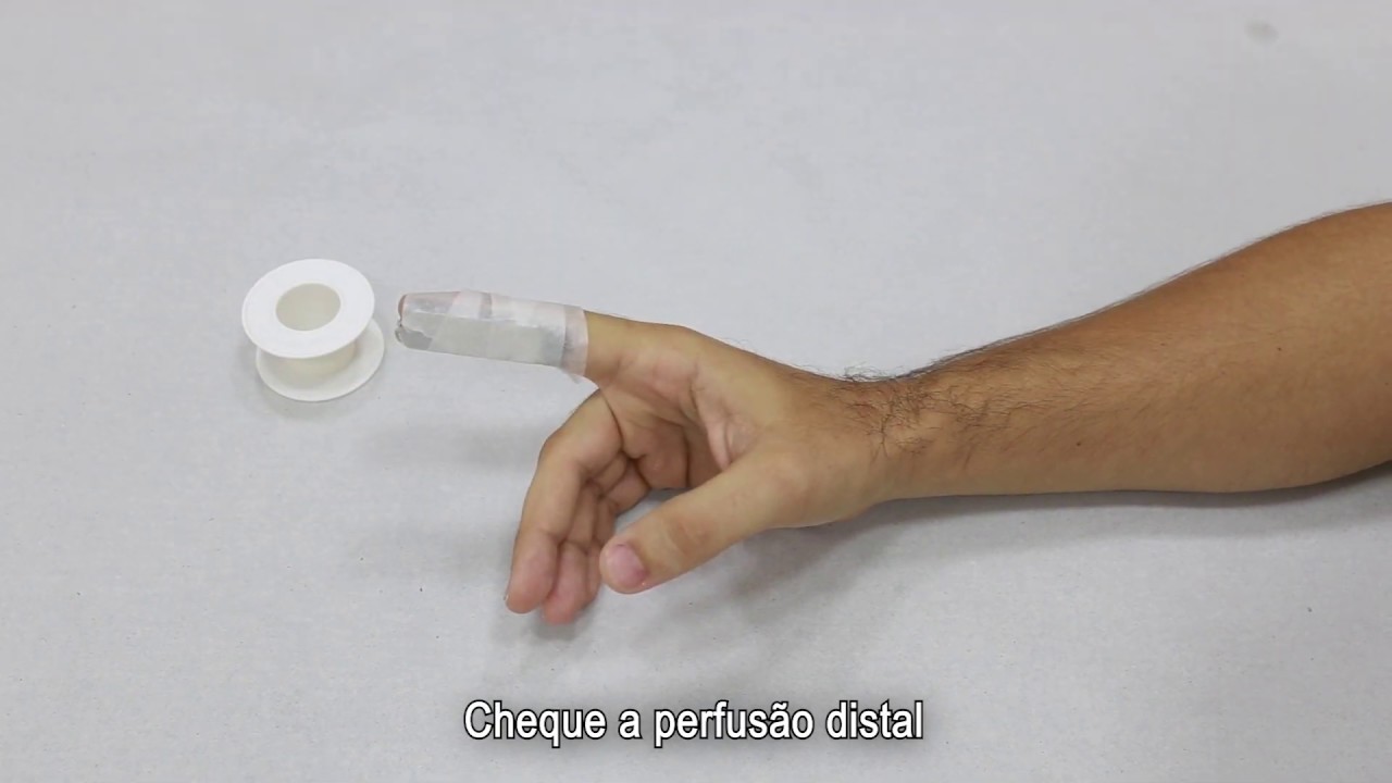 Tala metálica curta.