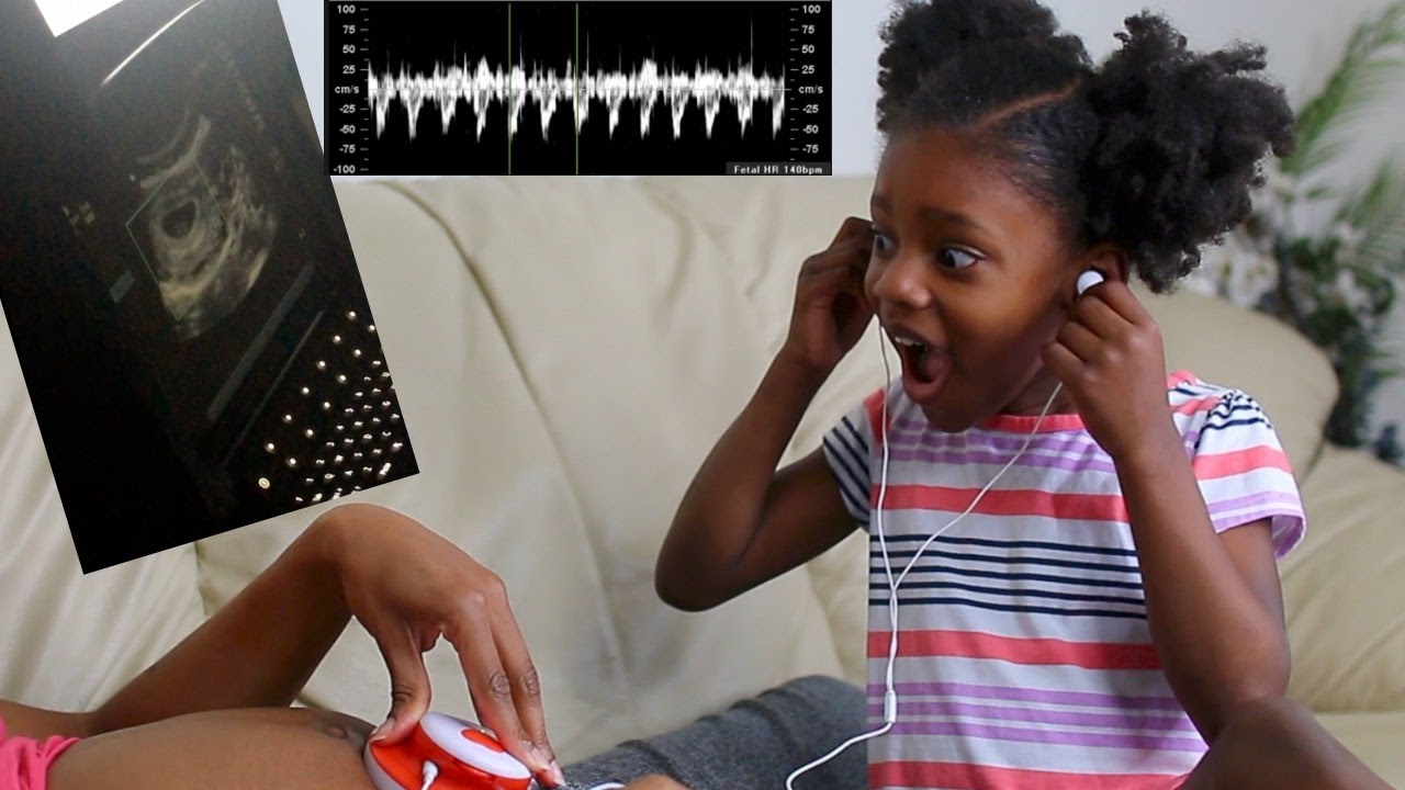 Hearing Baby's Heartbeat for the FIRST TIME! 3 Months Pregnant