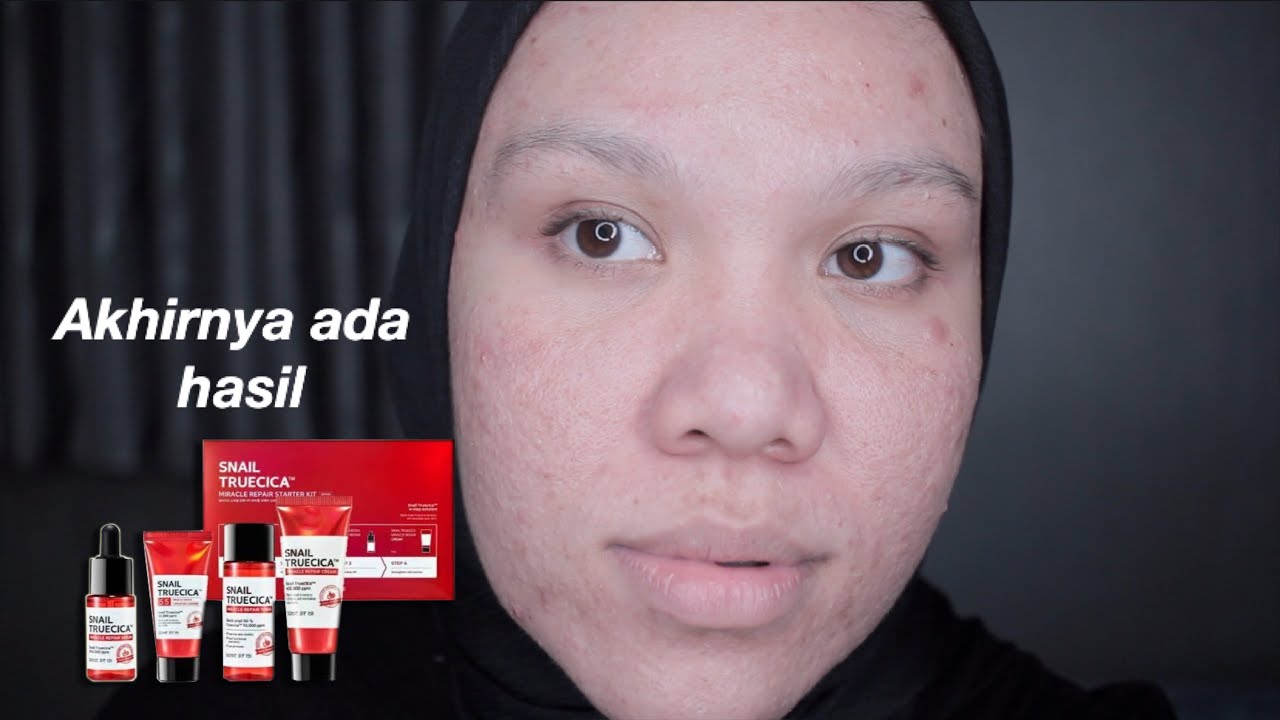 Kelanjutan Snail Truecica & Cara penggunaannya