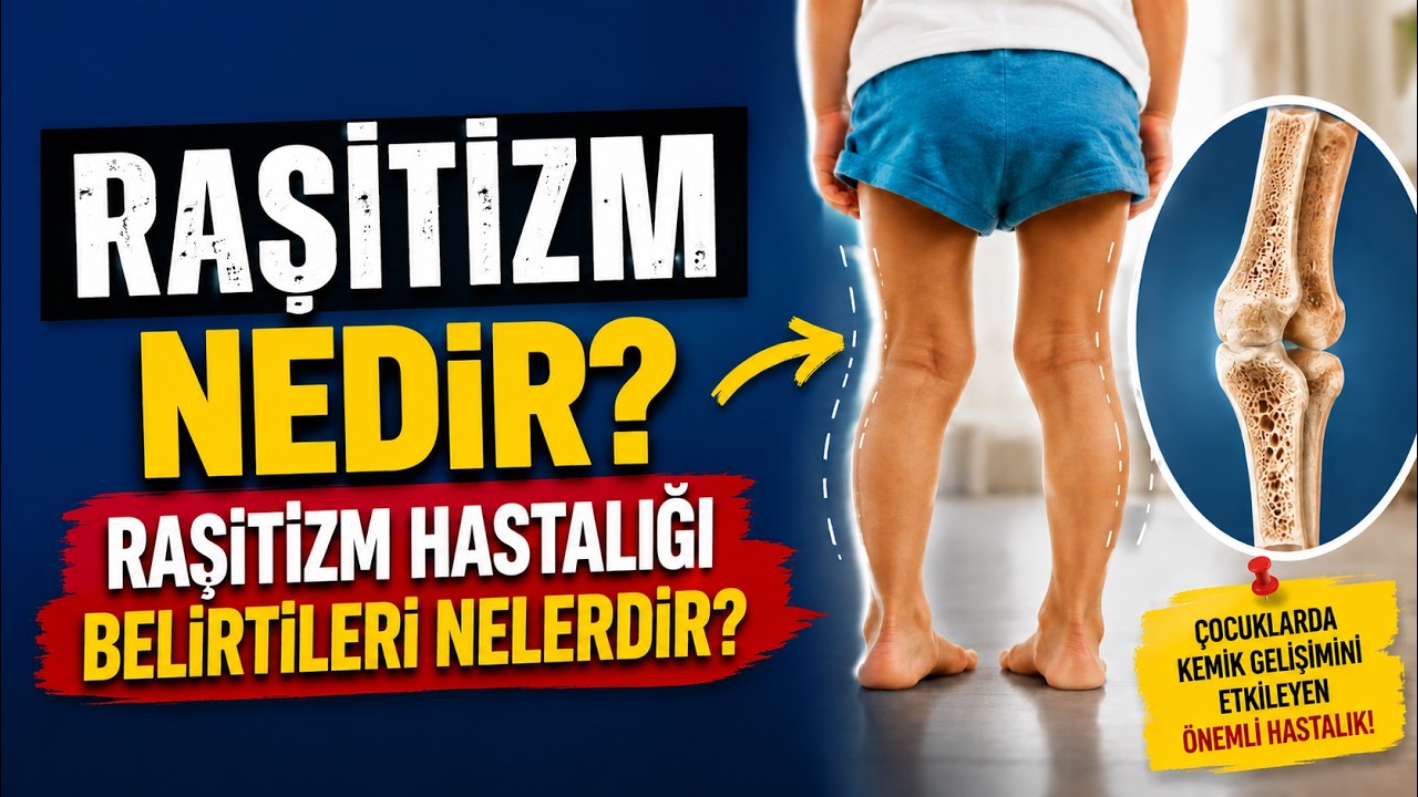 Raşitizm Nedir? Raşitizm Hastalığı Belirtileri Nelerdir? | Prof. Dr. Yakup Yıldırım