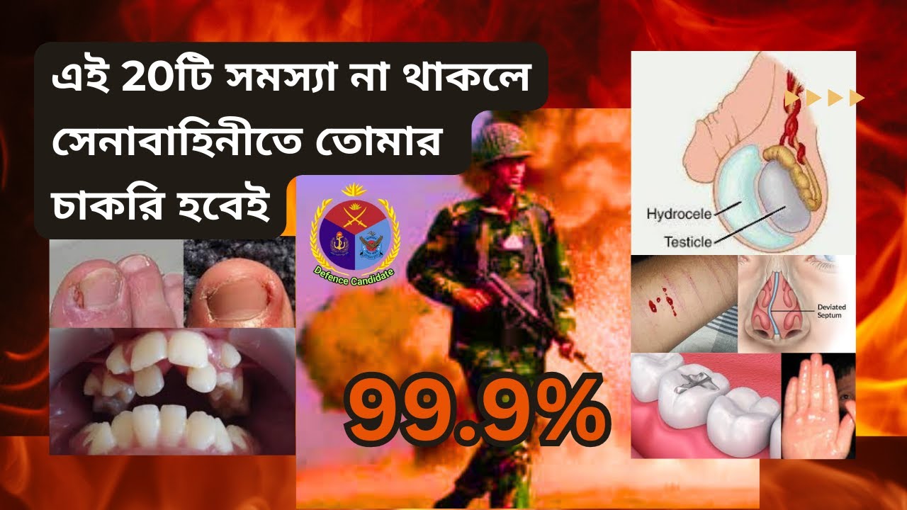 সেনাবাহিনীর মেডিকেল  | সেনাবাহিনীতে মেডিকেলে কি কি কারনে বাদ দেয়  |