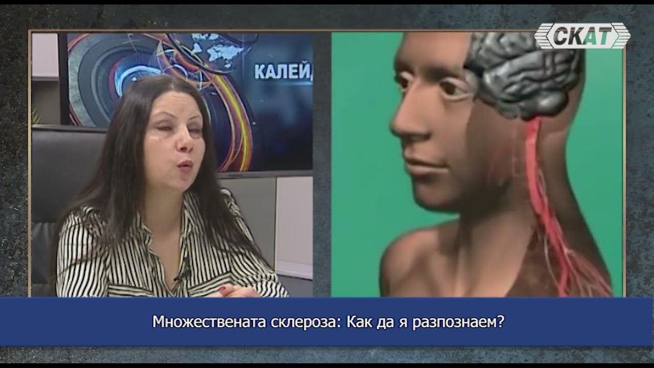 Множествената склероза: Как да я разпознаем?
