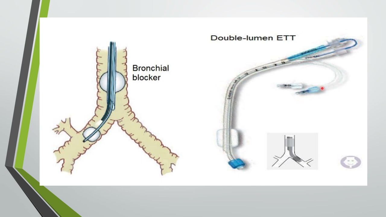 Anesthesia for thoracic surgery