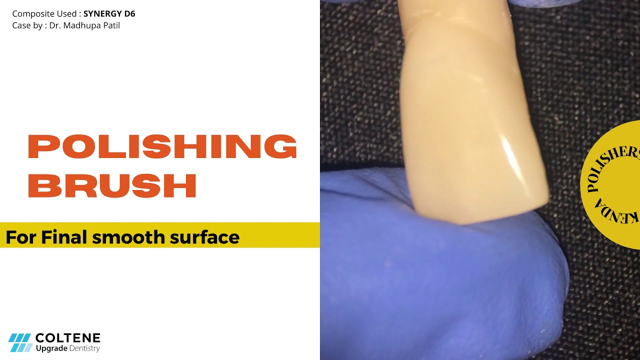 Steps of Composite Finishing and Polishing. How to achieve Mirror like Shine. DIATECH All in One.