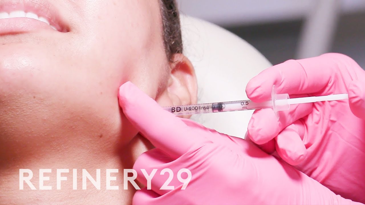 I Tried Jawline Contour & Masseter Botox | Macro Beauty | Refinery29