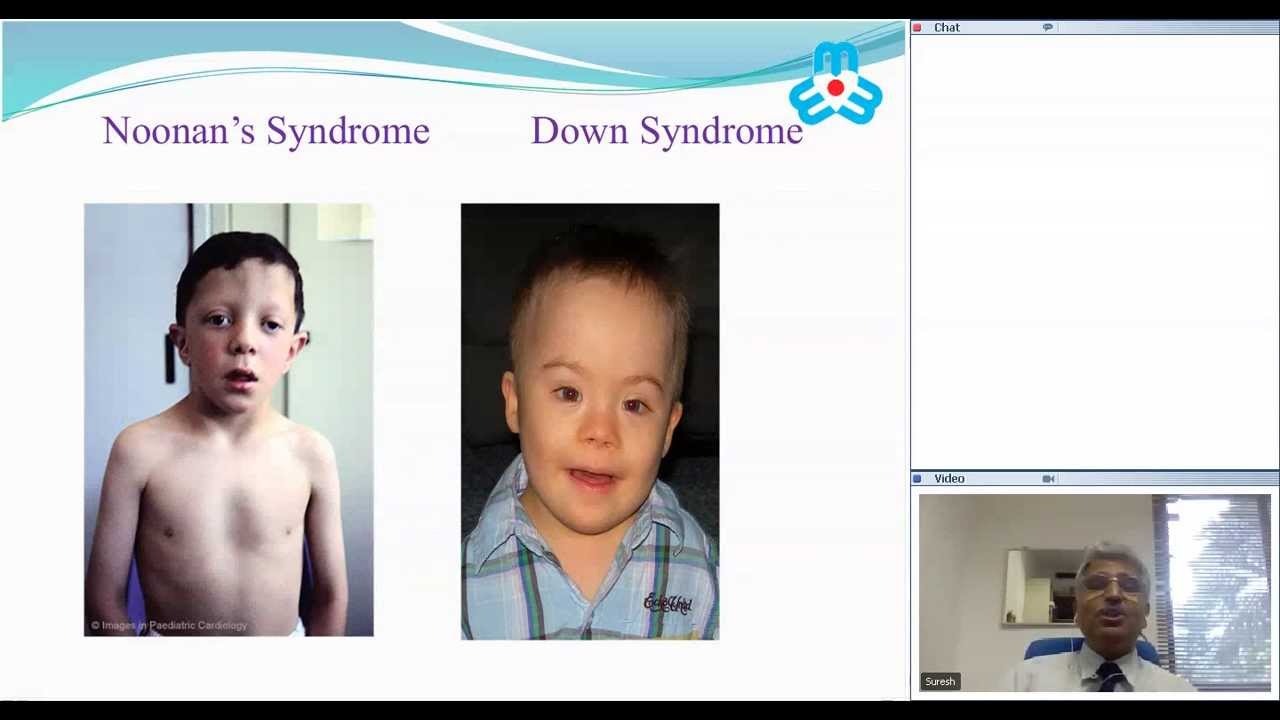 Clinical Examination of the Child with Heart Disease by Dr Suresh Kumar