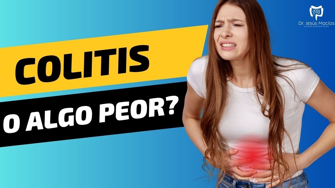 🩺 Colon Irritable (Colitis): Causas, Síntomas y Tratamiento. Explicado por un Gastroenterólogo