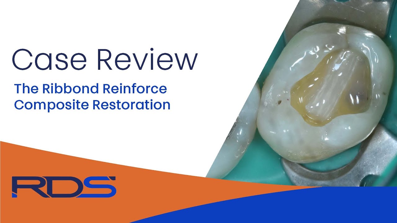 The Ribbond fiber reinforce composite restoration