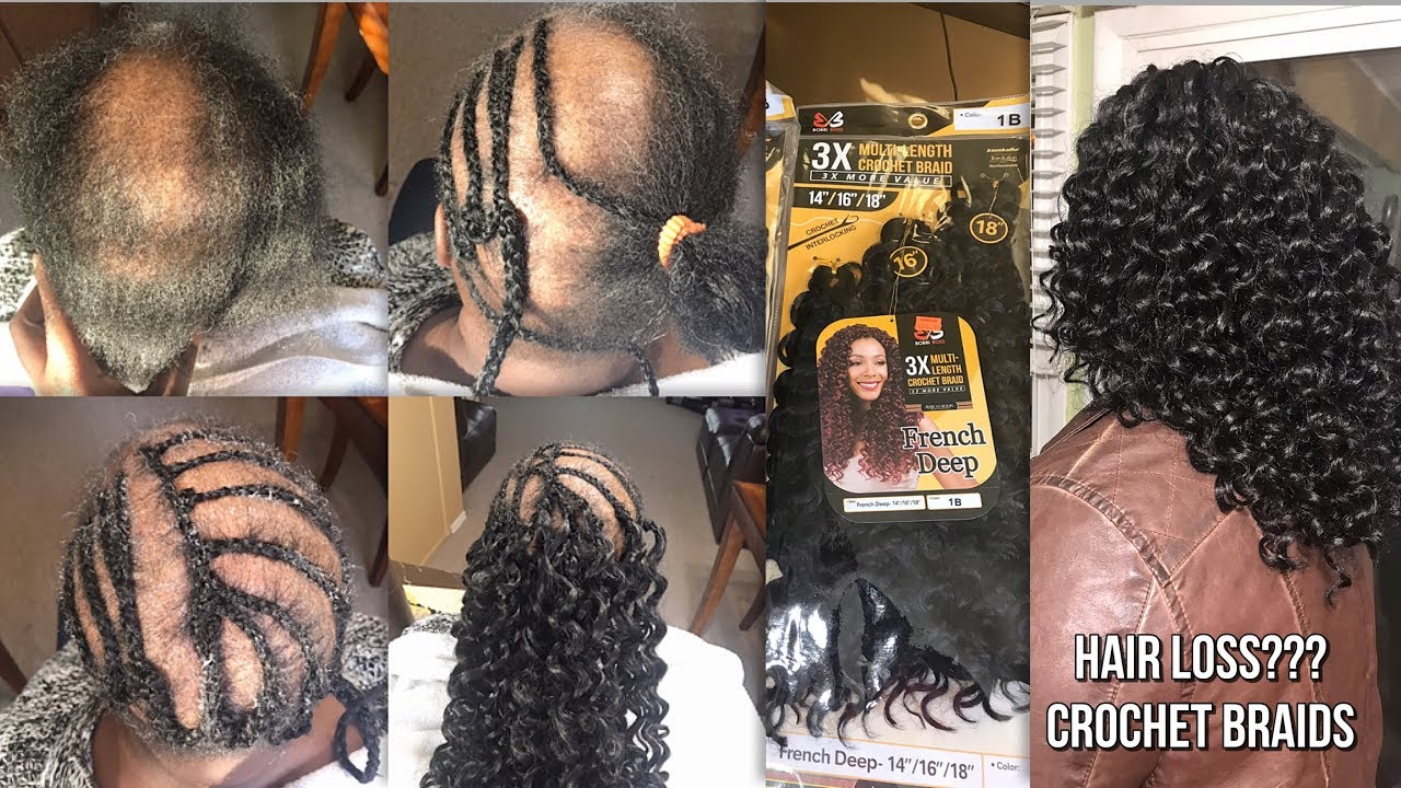 CROCHET BRAIDS WITH ALOPECIA - BOBBI BOSS 3X FRENCH DEEP