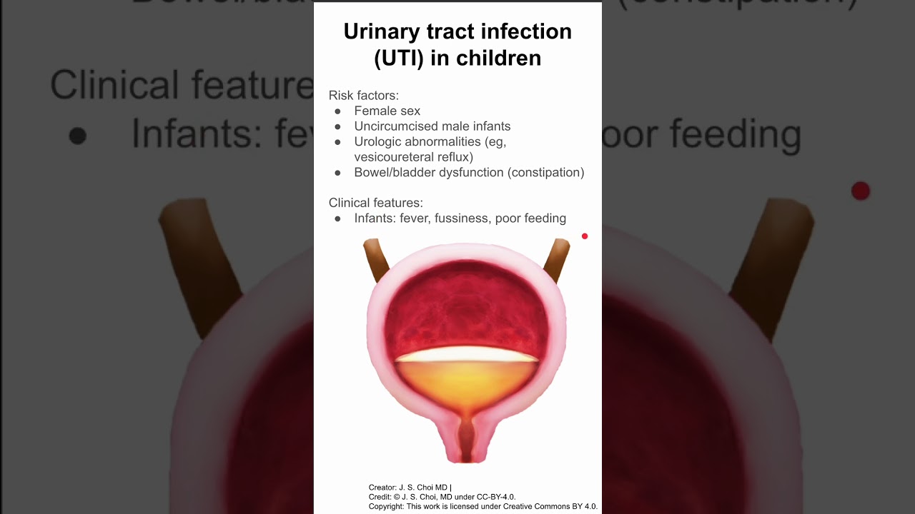 Urinary tract infection (UTI) in children
