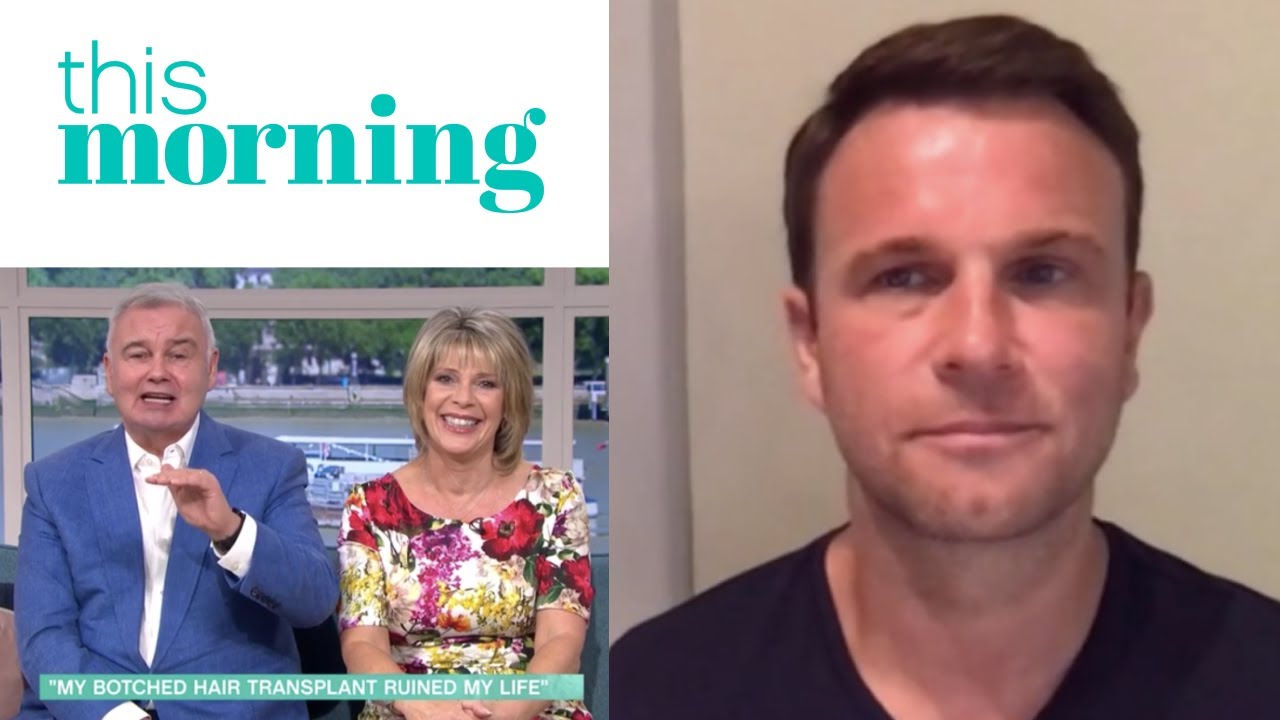 Spencer Stevenson (SpexHair) discusses botched hair transplants live on This Morning on ITV