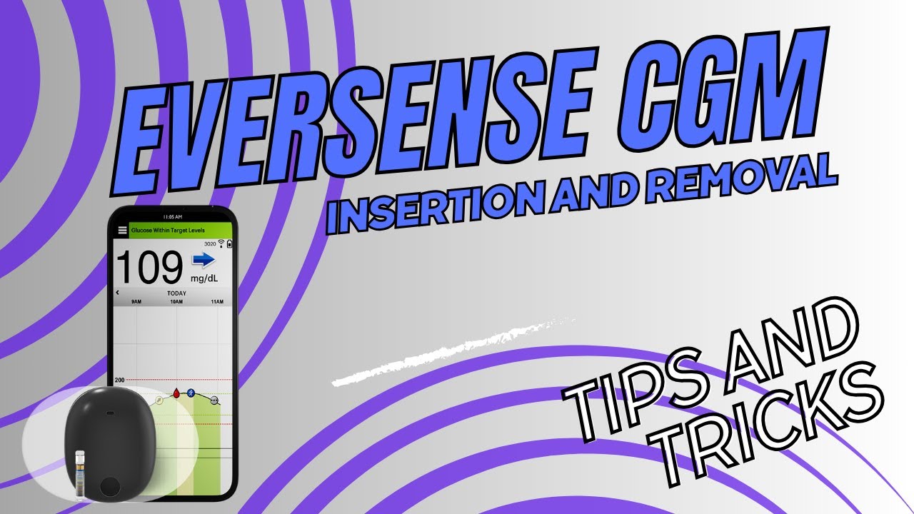 Eversense CGM Insertion and Removal Tips and Tricks